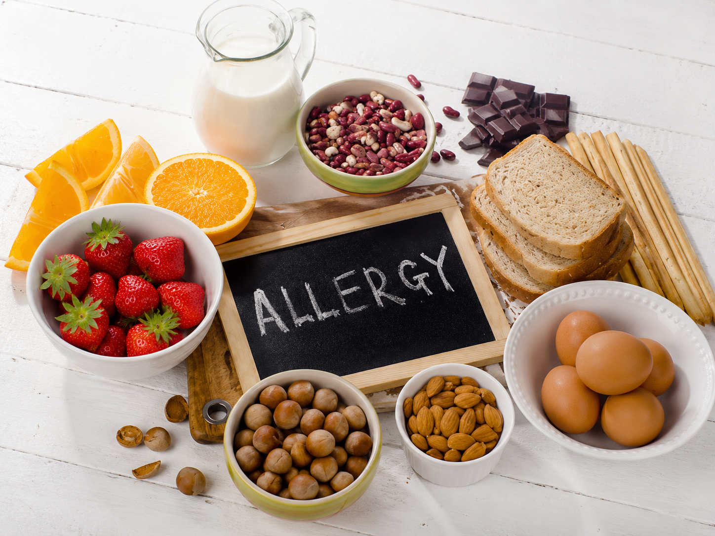 Food Allergies Testing In Bellevue WA