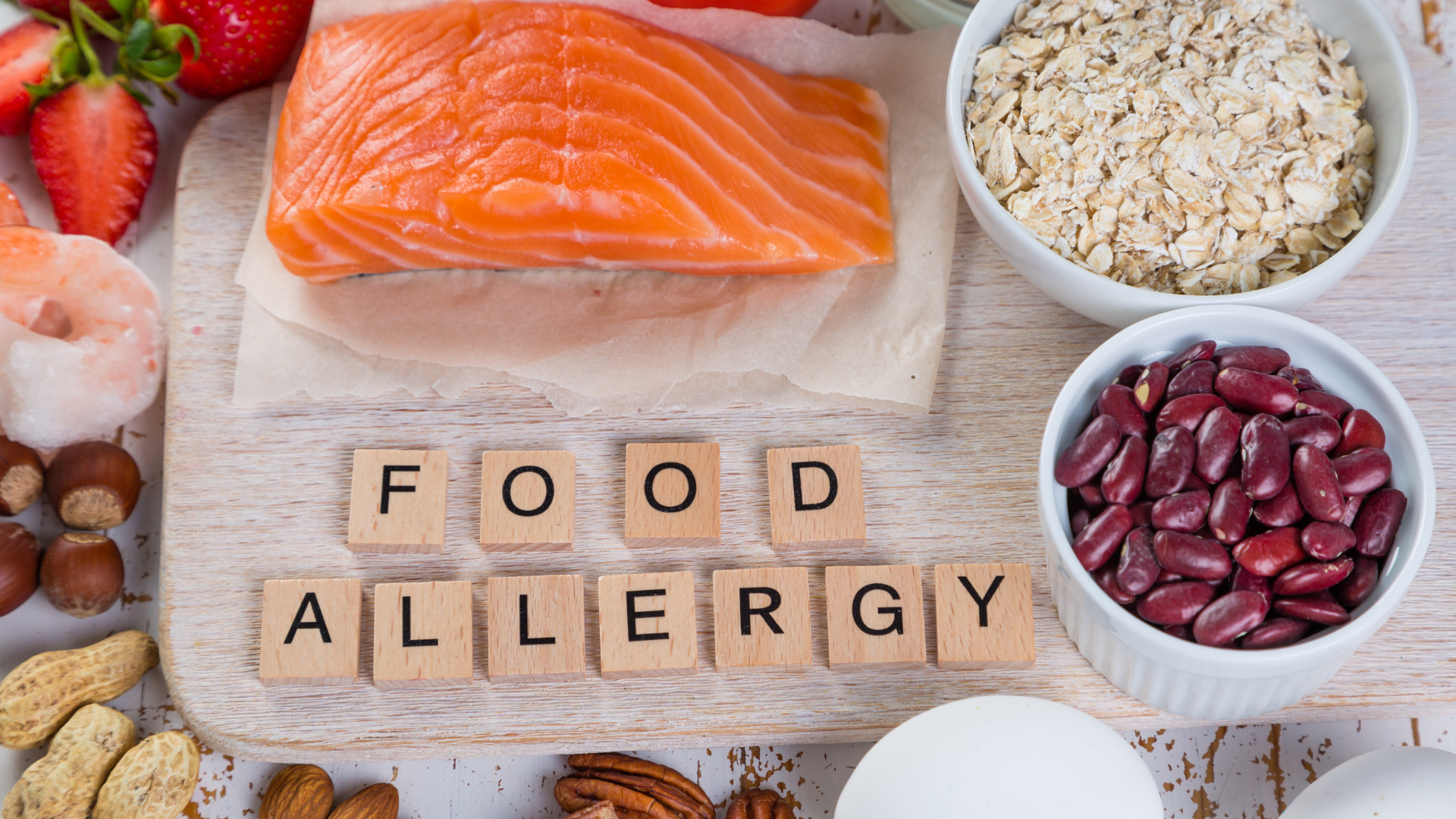 Food Allergy Testing - Bellevue, WA Restorative Natural Medicine