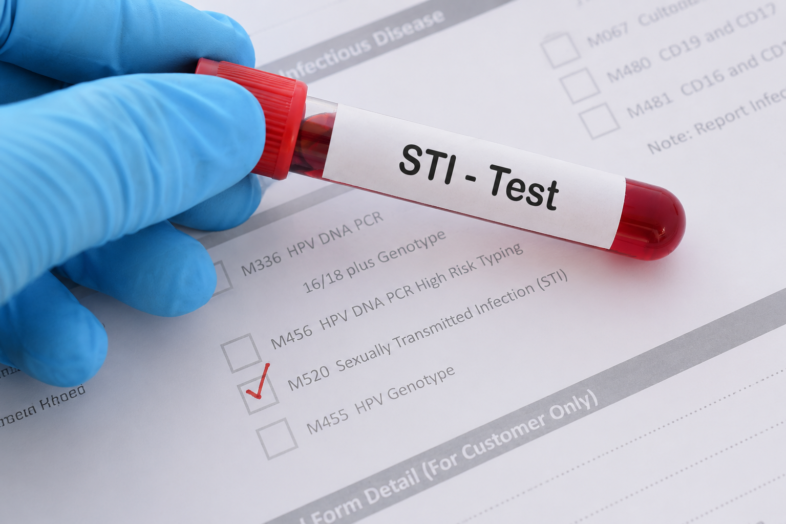 STD Testing & STI Testing in Bellevue